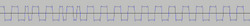 Biphase Mark Code.avif